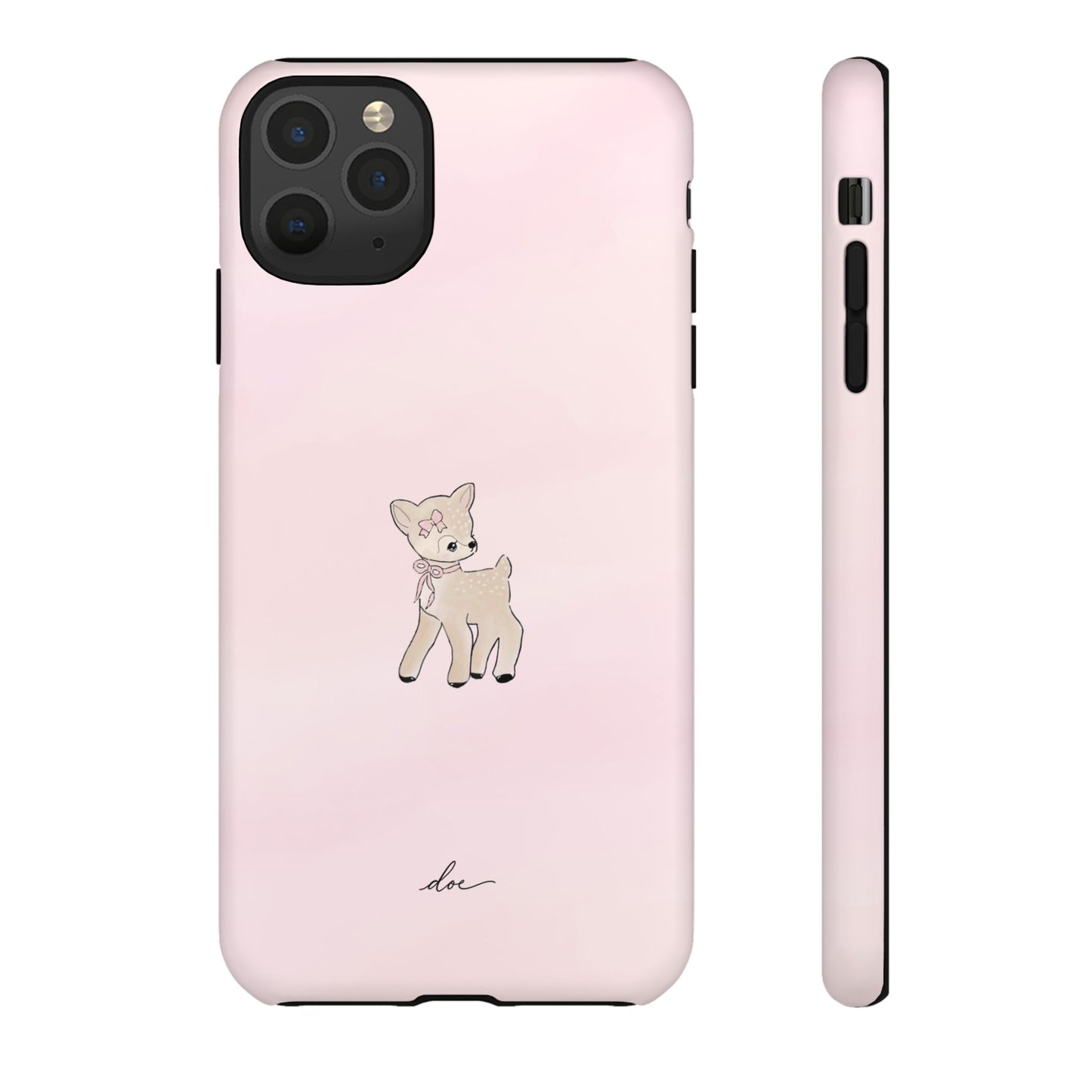 Deer Dreams iPhone Case